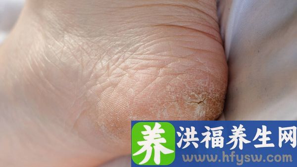 长期脚后跟疼怎么回事