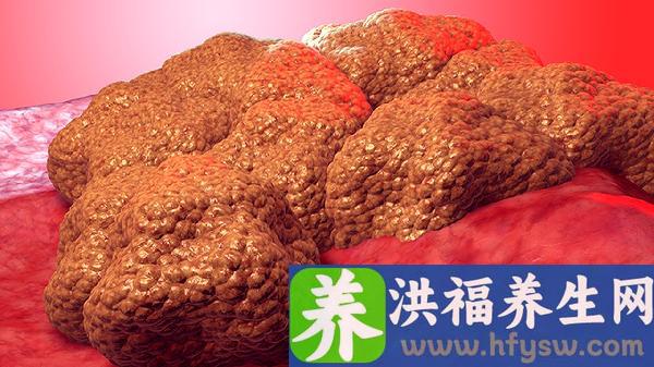 老年肿瘤患者常见的心理行为问题