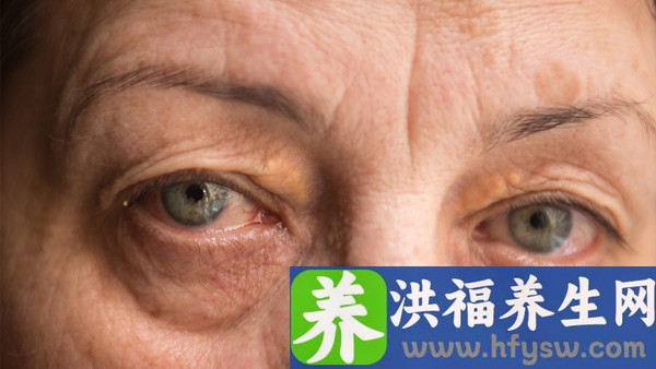 急性前列腺炎怎么查