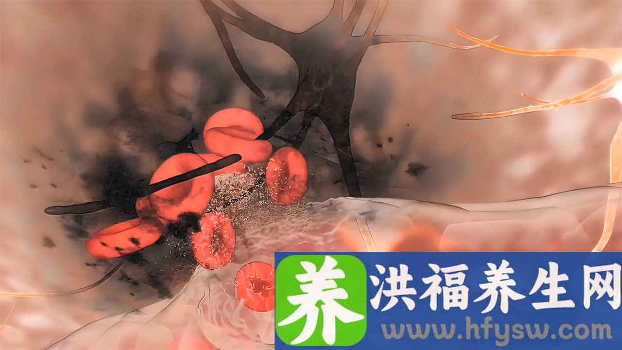 脑动脉瘤会头晕吗