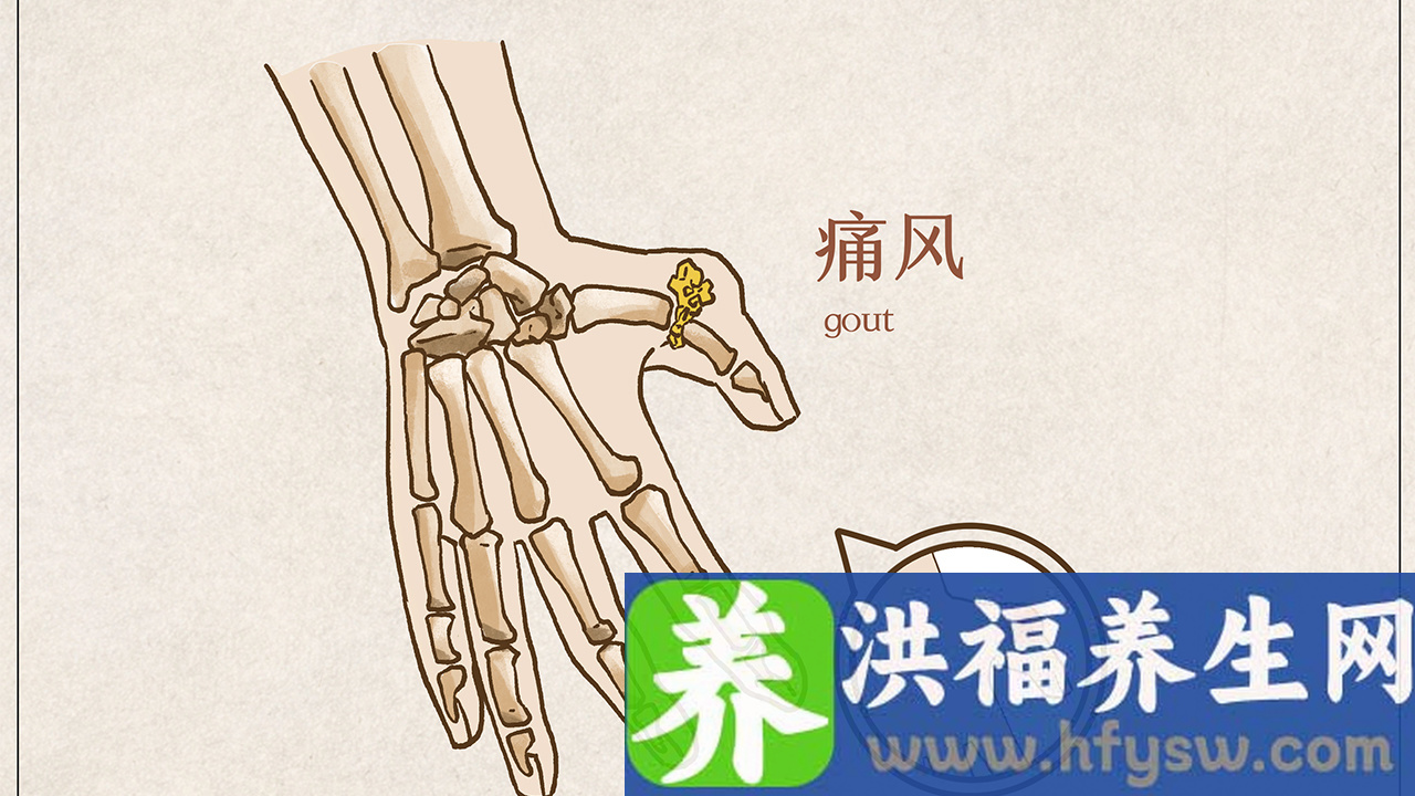 痛风能吃红薯吗