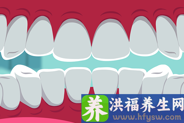 中老年人缺牙有什么影响？