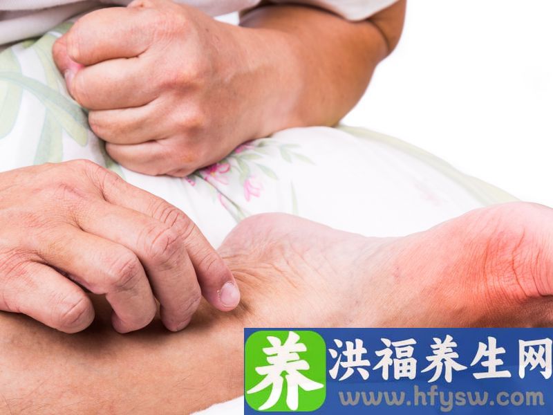 得了痛风，哪些食物能吃？哪些不能吃？别光顾着享受美食搭上健康