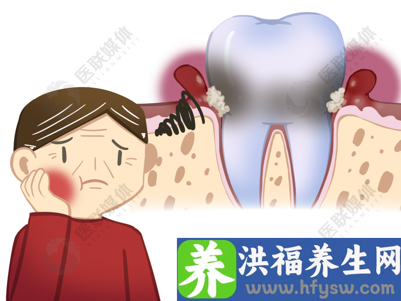 患者“牙疼”竟是心脏在“报警”！接诊医生果断处理，胸痛中心绿色通道接力使其转危为安