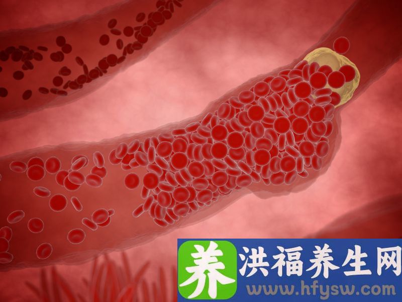 得了心脑血管病的人，要记得多吃这6种食物，大有好处