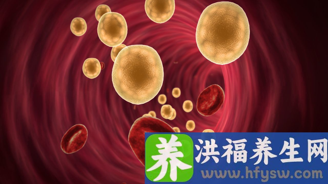 胆固醇偏高的症状