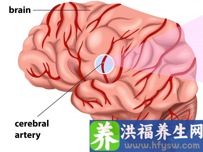 男人到了45岁，牢记饮食3不要，血管健康，远离脑梗