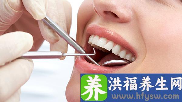 口腔牙齿美白注意事项有哪些