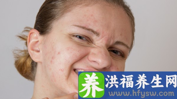 脸上的扁平疣怎么根除好呢 十三味菥蓂丸是抗病毒的药吗