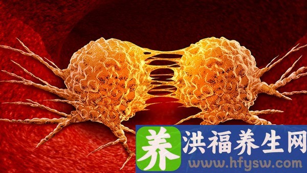 莫名其妙得了尖锐湿疣，复发怎么办