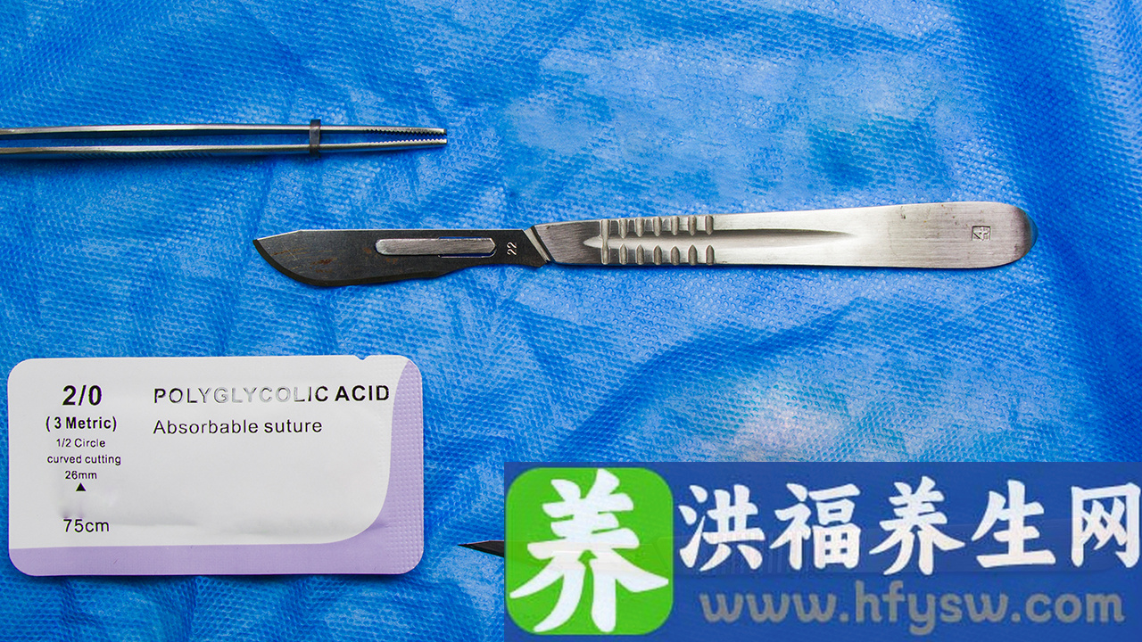 硫酸厂上班对身体有害吗