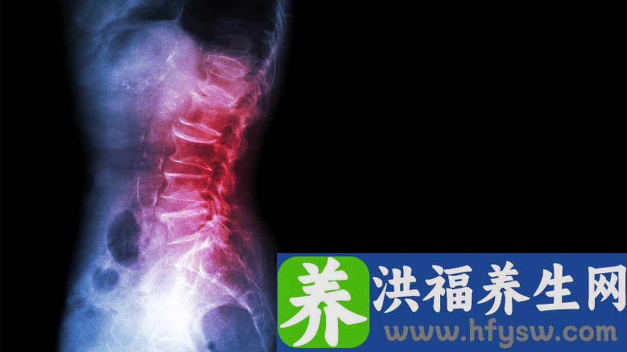 骨刺脚跟疼怎么治疗