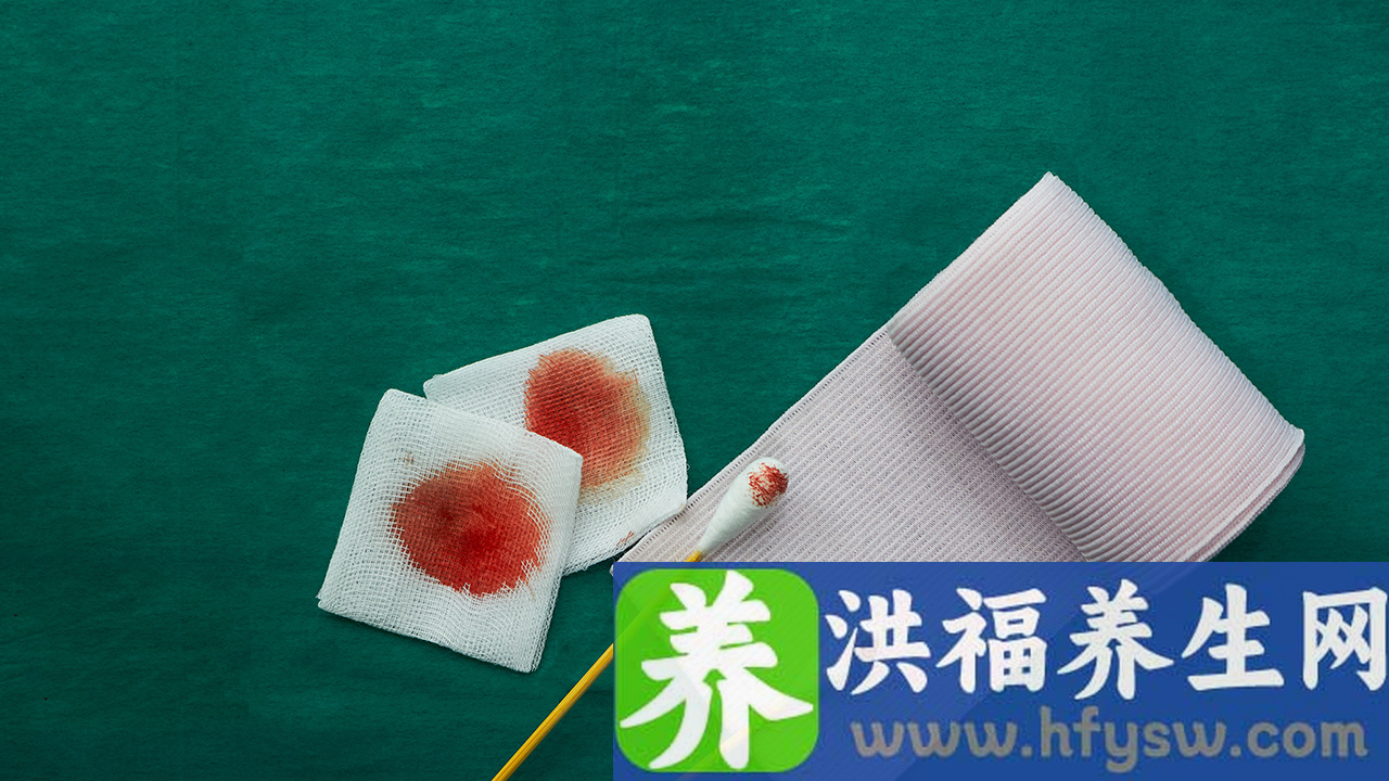 血常规静脉血与指尖血相同吗
