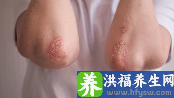 藿香正气滴丸对诺如病毒有用吗