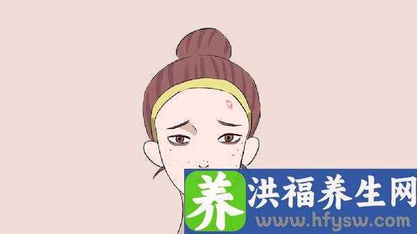 做冷冻治疗去痘疤手术注意事项是什么？