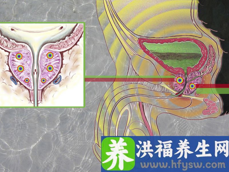 非淋菌尿道炎的症状