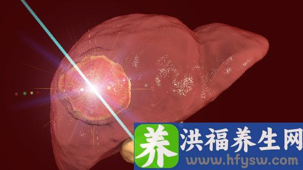 胆囊充满型结石的症状都有哪些