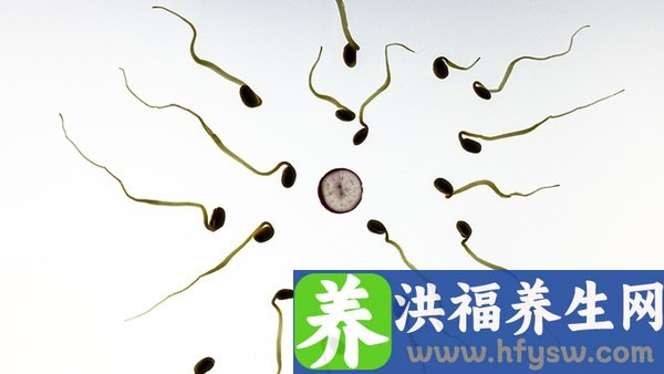 精子检查诊断男性不育症