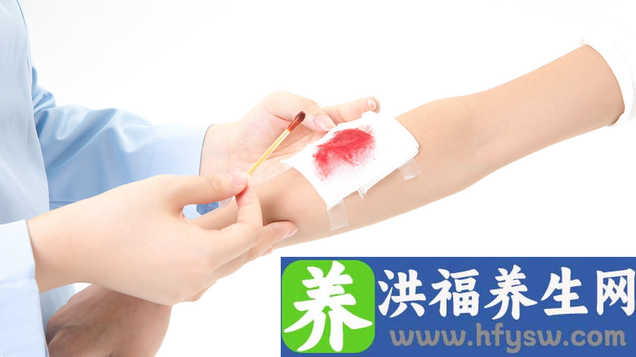 上臂神经疼痛怎么治疗