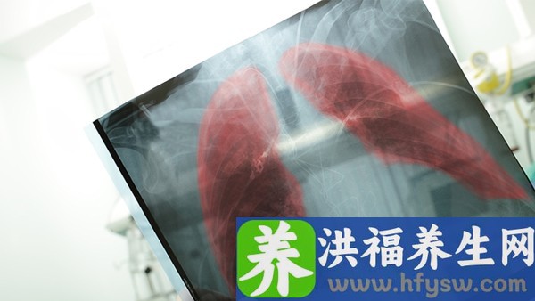 女性不孕检查的费用是多少？什么原因影响了不孕检查费用？