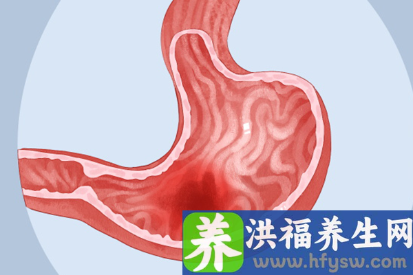 老人胃不好吃什么养胃