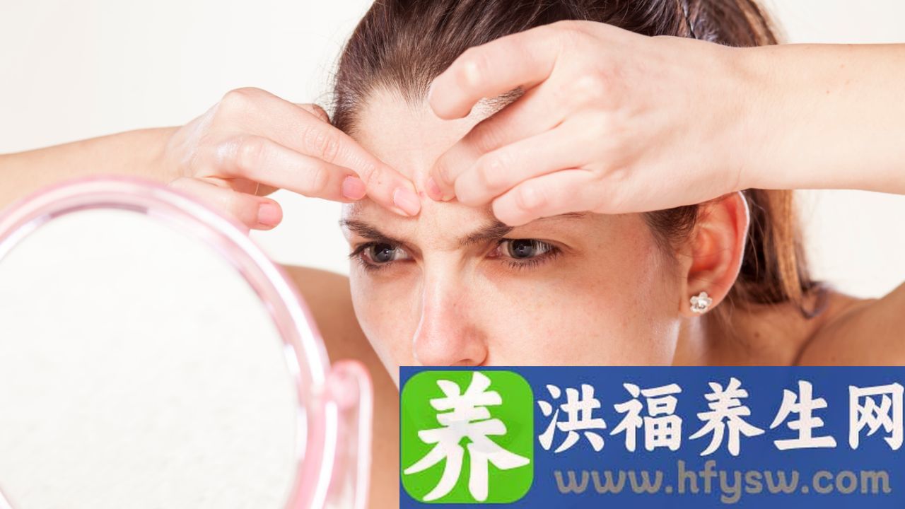 红斑狼疮会误诊为玫瑰痤疮吗