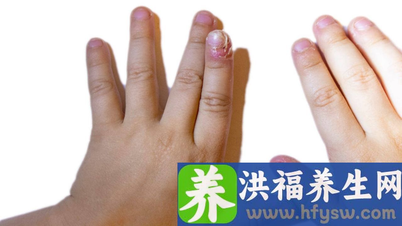 小指发麻是什么原因