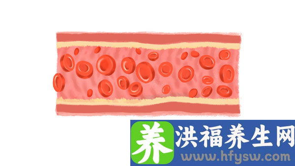 缺铁性贫血铁代谢检测指标有哪些变化