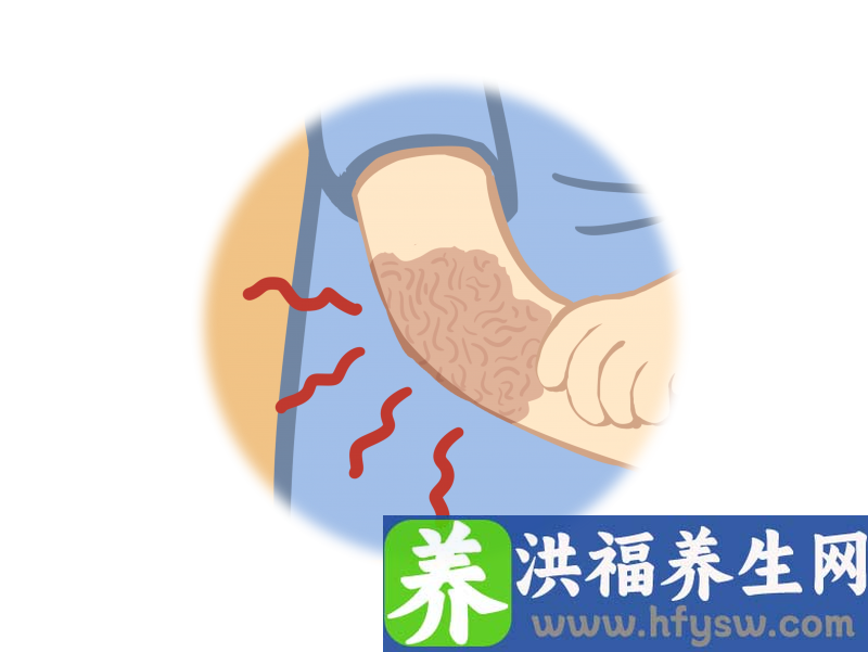 孩子烧烫伤，现场急救是第一要务