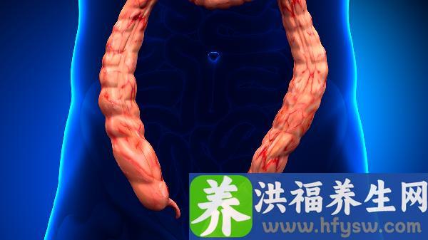 大便化验可以查出结肠炎吗