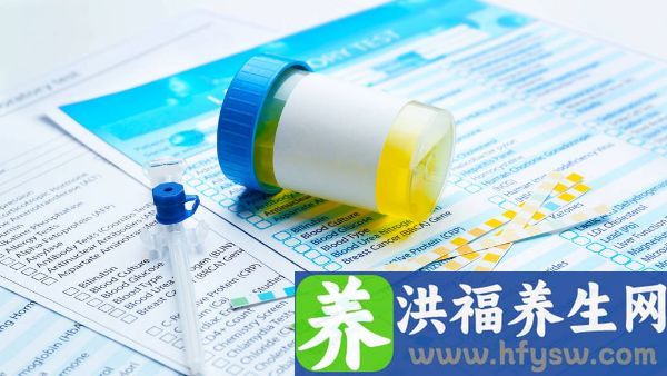 撒尿泡沫多泡沫不消失怎么回事