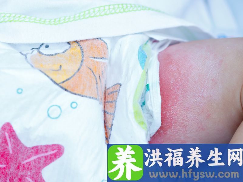 尿道口发痒的原因