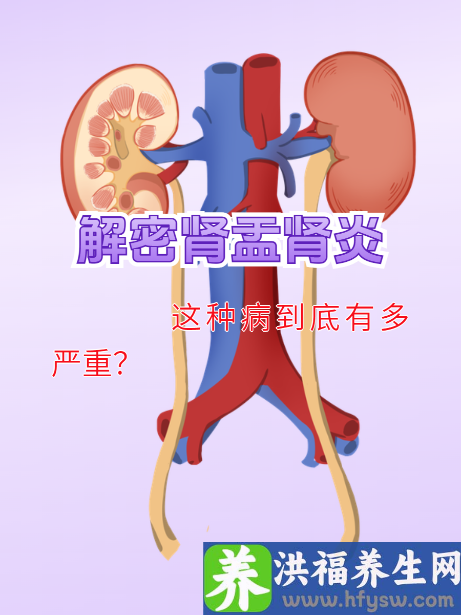 解密肾盂肾炎：这种病到底有多严重？