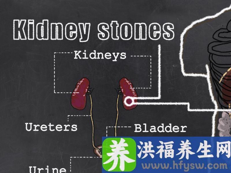 不想肾病“夺”走你的命，这4种食物最好一口别碰
