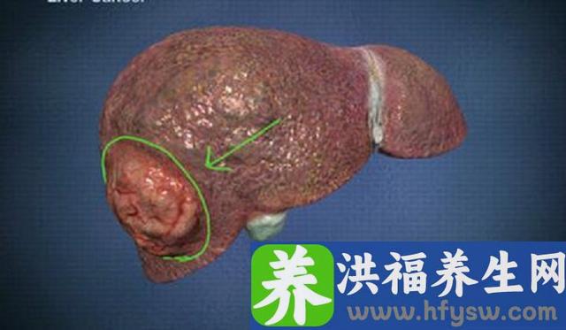养肝就是养命，这些水果是养肝的“解毒王”，你吃对了吗